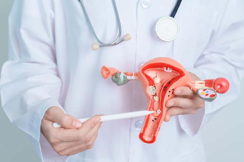 Polycystic Ovarian Syndrome (PCOS)